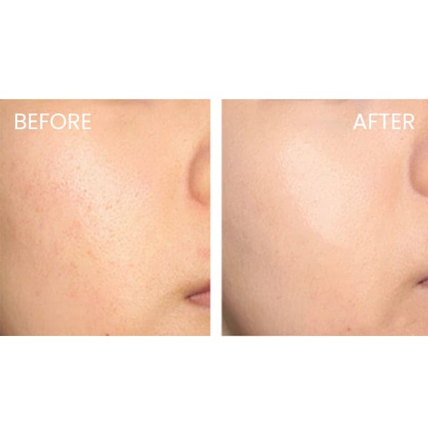 SKIN1004 Madagascar Centella Tone Brightening Boosting Toner